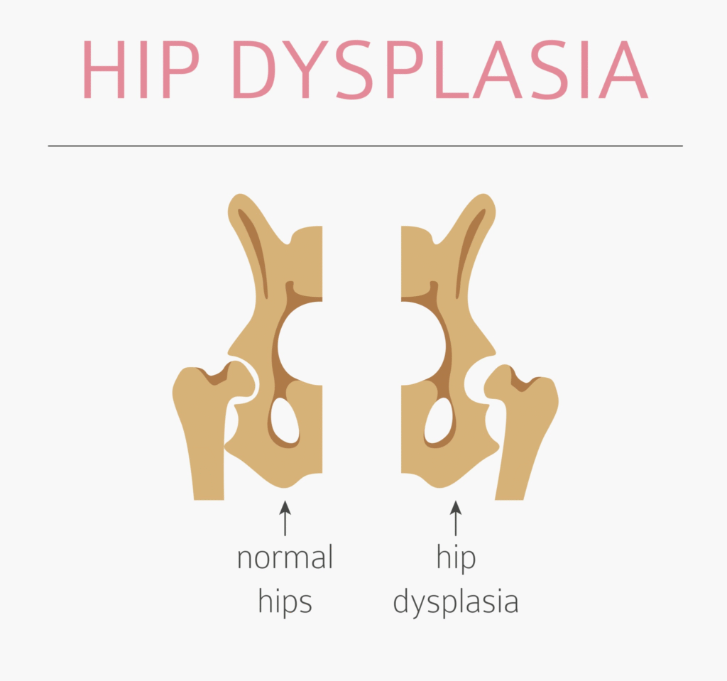 Anatomy of hip dysplasia causing a dog unable to sit or rise quickly